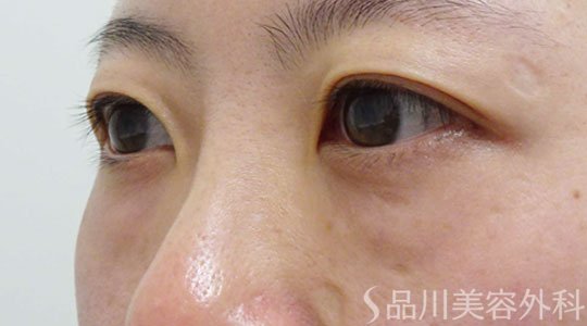 症例NO.66120のBEFORE写真