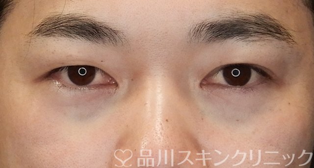 症例NO.66977のAFTER写真