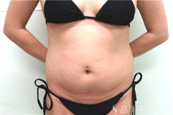 症例NO.18186のBEFORE写真
