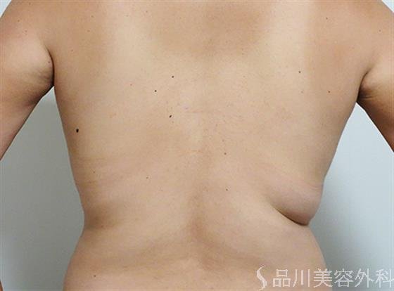 症例NO.24821のBEFORE写真