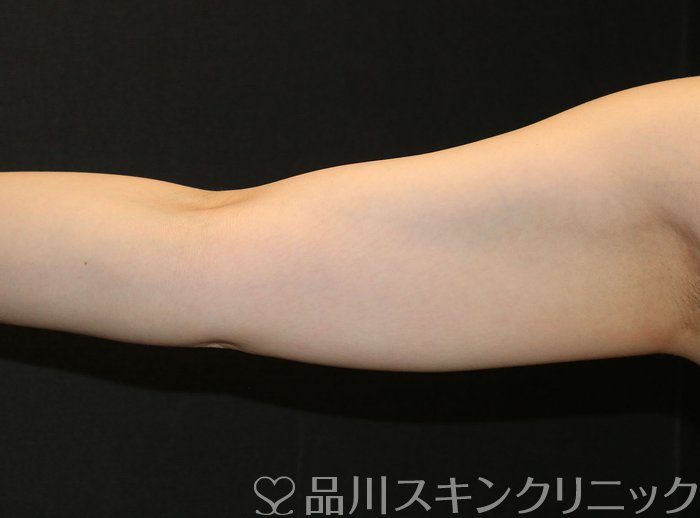 症例NO.74191のBEFORE写真