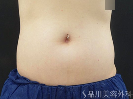 症例NO.70205のBEFORE写真