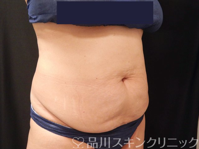 症例NO.68086のBEFORE写真