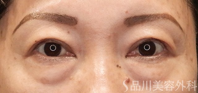 症例NO.73131のBEFORE写真