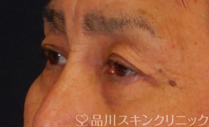 症例NO.66631のAFTER写真