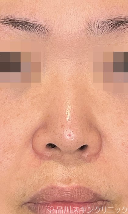 症例NO.75091のBEFORE写真