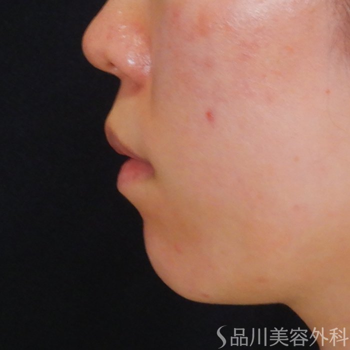 症例NO.67899のBEFORE写真