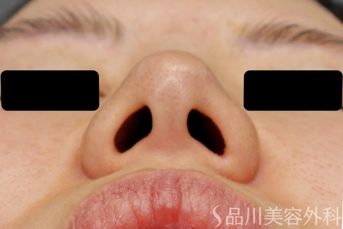 症例NO.73567のBEFORE写真