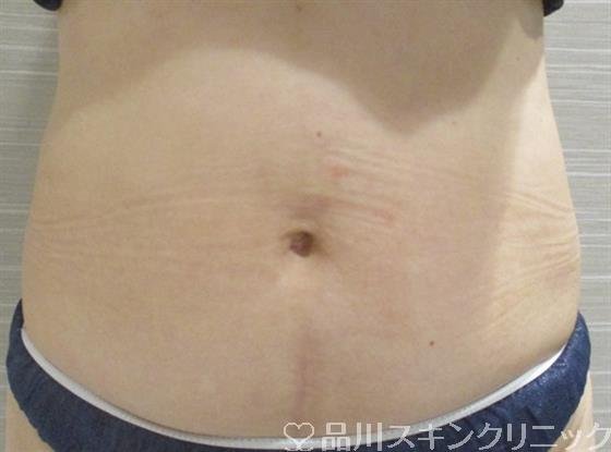 症例NO.36192のBEFORE写真