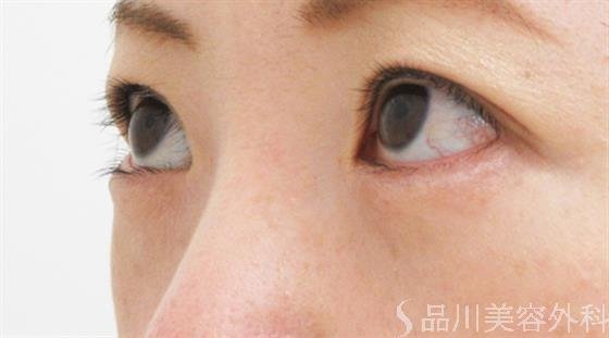 症例NO.22977のAFTER写真