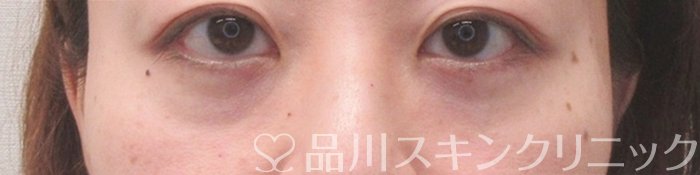 症例NO.71270のBEFORE写真