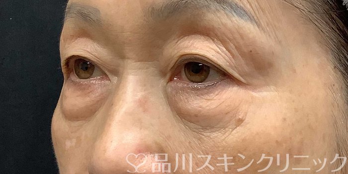 症例NO.69668のBEFORE写真