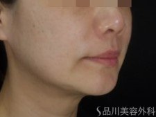 症例NO.73203のBEFORE写真