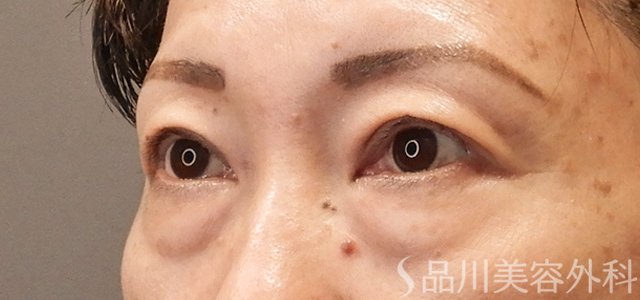 症例NO.73131のBEFORE写真