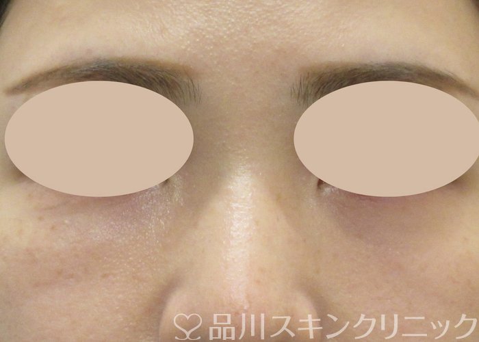 症例NO.73797のAFTER写真