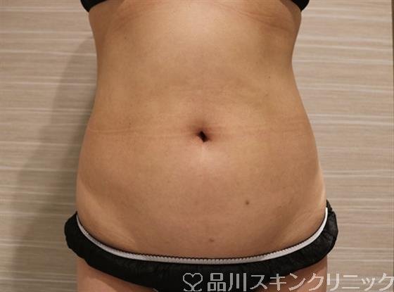 症例NO.42188のBEFORE写真