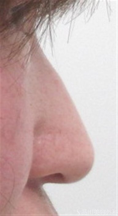 症例NO.16528のBEFORE写真