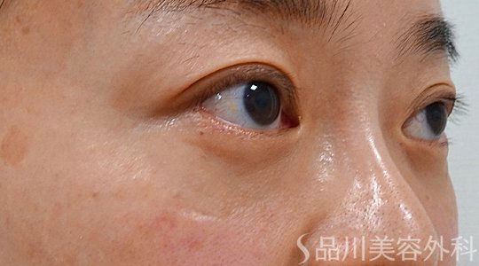 症例NO.73656のAFTER写真