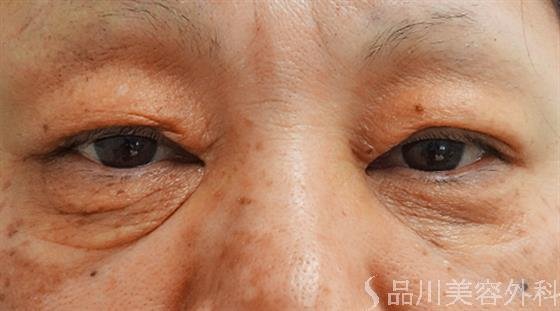 症例NO.30262のBEFORE写真