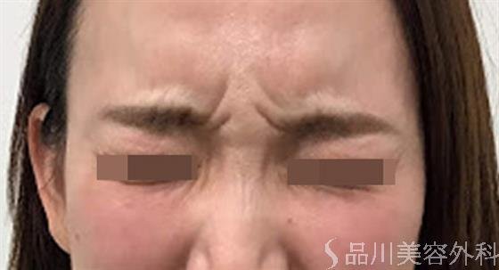 症例NO.47157のBEFORE写真