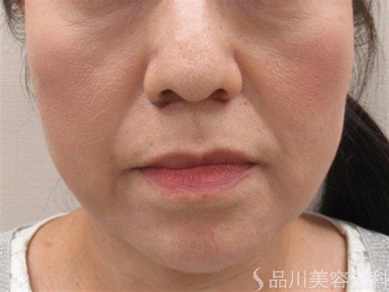 症例NO.36094のBEFORE写真