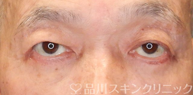 症例NO.65607のAFTER写真