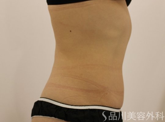 症例NO.67266のBEFORE写真