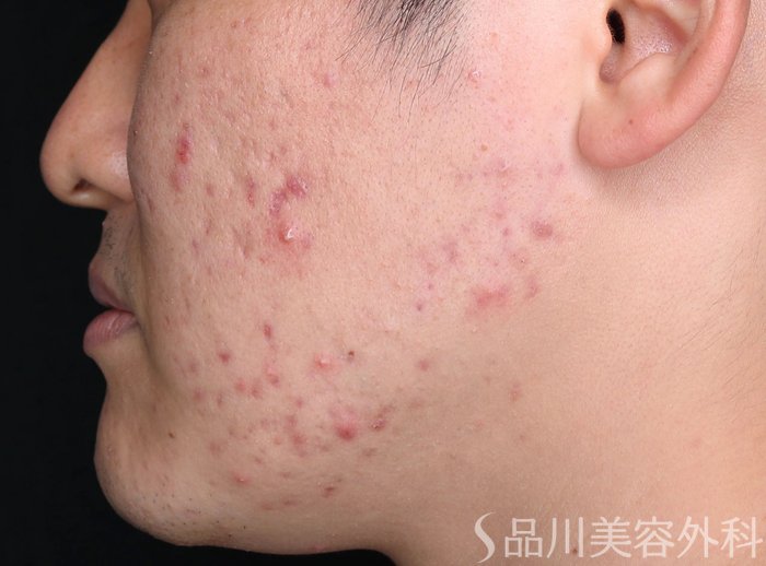 症例NO.67421のBEFORE写真