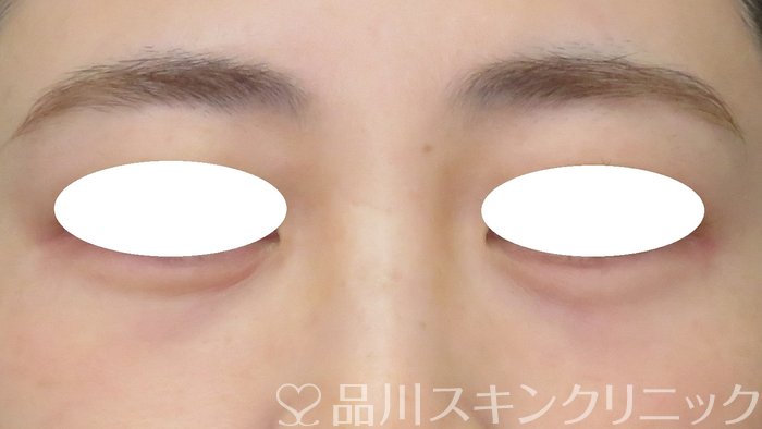 症例NO.70430のAFTER写真