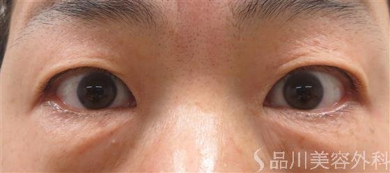 症例NO.28131のBEFORE写真