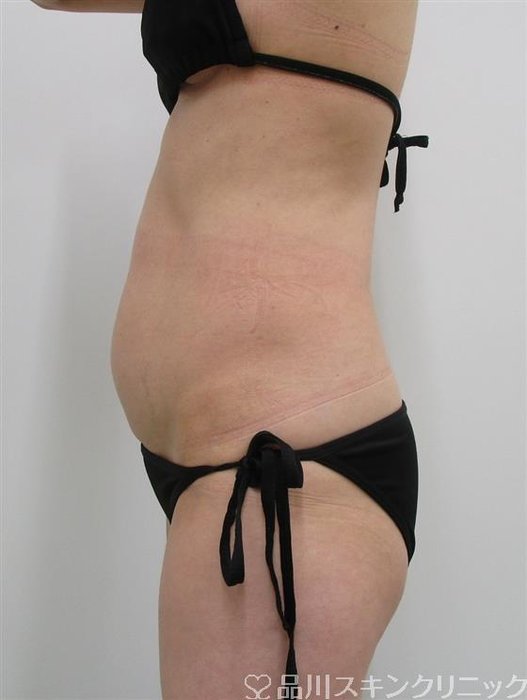症例NO.40657のBEFORE写真