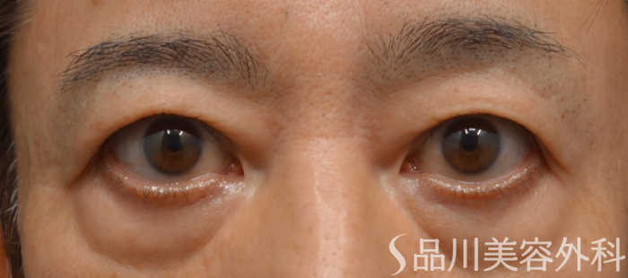 症例NO.65030のBEFORE写真