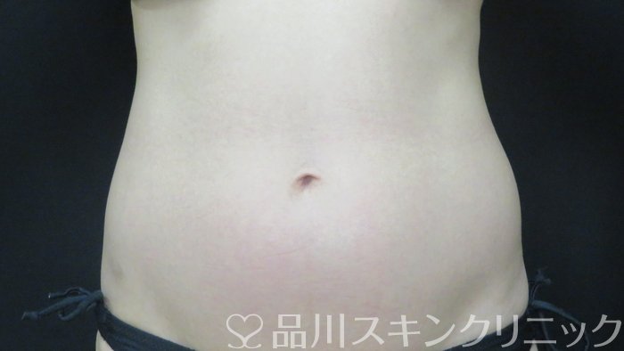 症例NO.71120のBEFORE写真