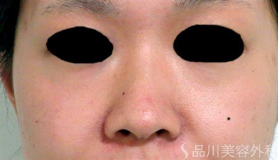 症例NO.31659のBEFORE写真