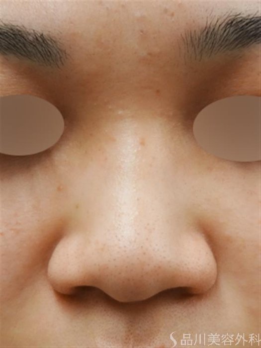 症例NO.30271のBEFORE写真