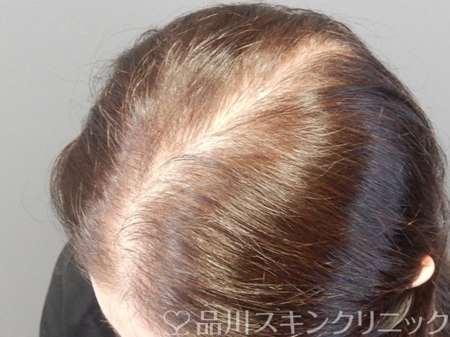 症例NO.68636のBEFORE写真