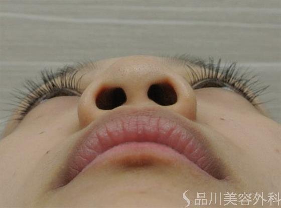 症例NO.16431のBEFORE写真
