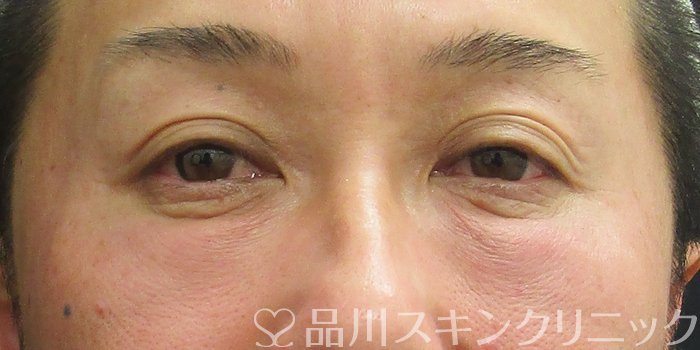 症例NO.73198のAFTER写真