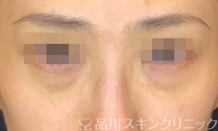 症例NO.71802のBEFORE写真