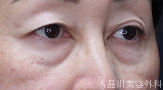 症例NO.73540のBEFORE写真