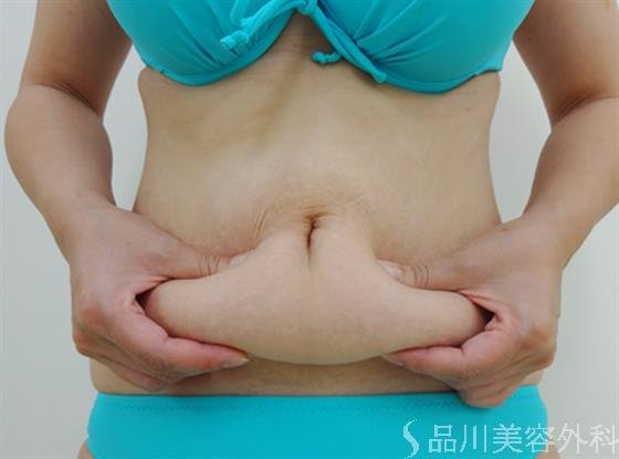 症例NO.26701のAFTER写真