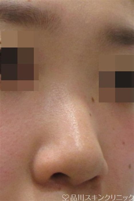 症例NO.27138のBEFORE写真