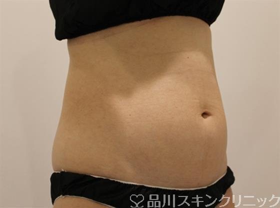 症例NO.47579のBEFORE写真