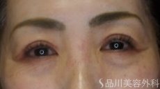 症例NO.72711のAFTER写真