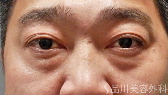 症例NO.65294のBEFORE写真