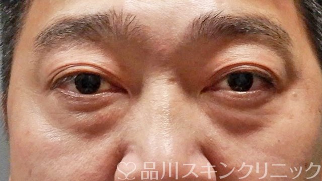 症例NO.65294のBEFORE写真