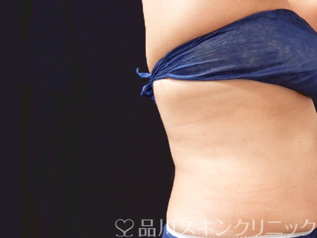症例NO.67279のAFTER写真