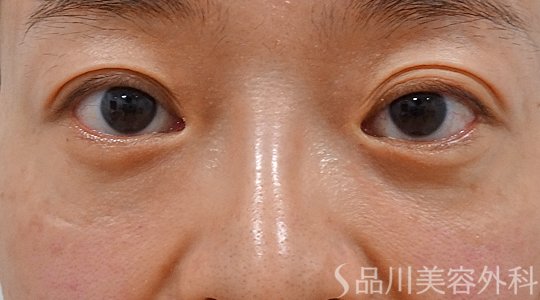 症例NO.73656のAFTER写真