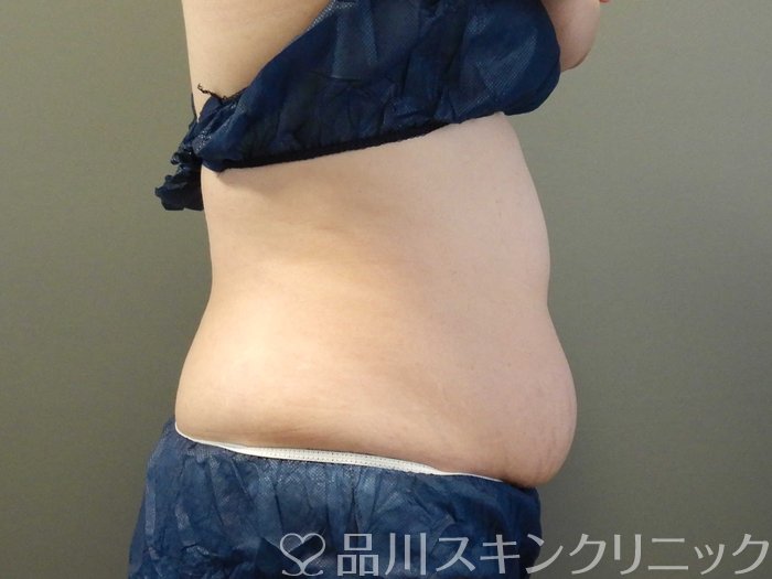 症例NO.65954のBEFORE写真