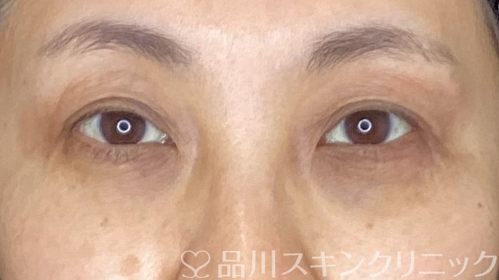 症例NO.70873のBEFORE写真